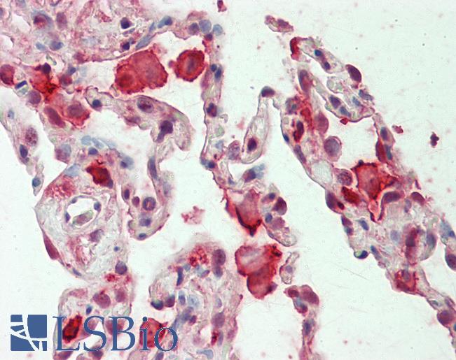 Anti-CAPG / MCP antibody IHC staining of human lung. Immunohistochemistry of formalin-fixed, paraffin-embedded tissue after heat-induced antigen retrieval. Antibody LS-B11275 concentration 5 ug/ml.