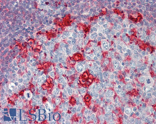 Anti-CAPG / MCP antibody IHC staining of human tonsil. Immunohistochemistry of formalin-fixed, paraffin-embedded tissue after heat-induced antigen retrieval.