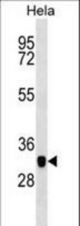CAPG Antibody western blot of HeLa cell line lysates (35 ug/lane). The CAPG antibody detected the CAPG protein (arrow).