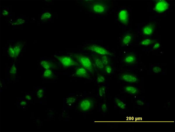 Immunofluorescence of monoclonal antibody to CAPG on HeLa cell. [antibody concentration 10 ug/ml]