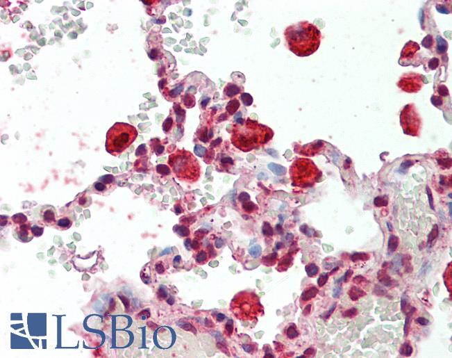 Human Lung, Macrophages: Formalin-Fixed, Paraffin-Embedded (FFPE)
