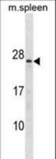 TNNC2 Antibody western blot of mouse spleen tissue lysates (35 ug/lane). The TNNC2 antibody detected the TNNC2 protein (arrow).