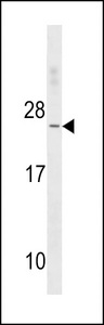 TNNC2 Antibody western blot of K562 cell line lysates (35 ug/lane). The TNNC2 antibody detected the TNNC2 protein (arrow).
