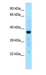 CAPZA1 / CAPZ antibody Western Blot of Fetal Liver.