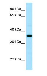 CAPZA1 / CAPZ antibody Western Blot of Fetal Lung.