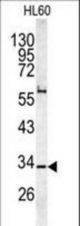 Western blot of CAPZA1 antibody in HL60 cell line lysates (35 ug/lane). CAPZA1 (arrow) was detected using the purified antibody.