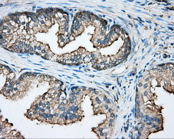 IHC of paraffin-embedded prostate tissue using anti-CAPZA1 mouse monoclonal antibody. (Dilution 1:50).