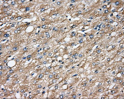 IHC of paraffin-embedded liver tissue using anti-CAPZA1 mouse monoclonal antibody. (Dilution 1:50).