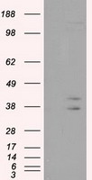 HEK293T cells were transfected with the pCMV6-ENTRY control (Left lane) or pCMV6-ENTRY CAPZA1 (Right lane) cDNA for 48 hrs and lysed. Equivalent amounts of cell lysates (5 ug per lane) were separated by SDS-PAGE and immunoblotted with anti-CAPZA1.