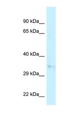 CAPZA2 antibody LS-C145938 Western blot of Fetal Heart lysate. Antibody concentration 1 ug/ml.