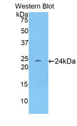 Western blot of recombinant TNNI1.