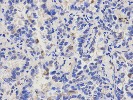 Immunohistochemistry of paraffin-embedded rat kidney using CAPZA2 antibody at dilution of 1:200 (400x lens).