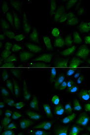 Immunofluorescence analysis of HepG2 cell using CAPZA2 antibody. Blue: DAPI for nuclear staining