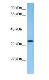 CAPZ / CAPZB antibody Western Blot of Rat Small Intestine.