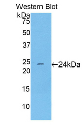 Western blot of recombinant TNNI1.