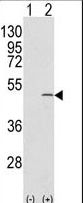 Western blot of CAPZB (arrow) using rabbit polyclonal CAPZB Antibody. 293 cell lysates (2 ug/lane) either nontransfected (Lane 1) or transiently transfected with the CAPZB gene (Lane 2).