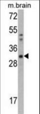 Western blot of CAPZB Antibody in mouse brain tissue lysates (35 ug/lane). CAPZB (arrow) was detected using the purified antibody.
