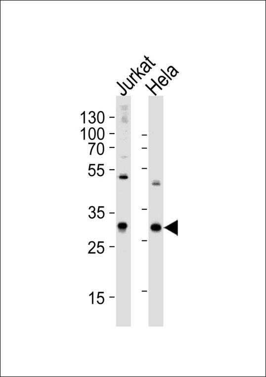 Western blot of lysates from Jurkat, HeLa cell line (from left to right), using CAPZB Antibody. Antibody was diluted at 1:1000 at each lane. A goat anti-rabbit IgG H&L (HRP) at 1:5000 dilution was used as the secondary antibody. Lysates at 35ug per lane.