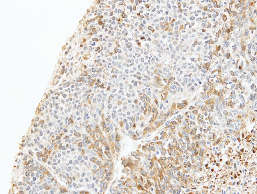 IHC of paraffin-embedded 59T xenograft using CapZ beta antibody at 1:100 dilution.