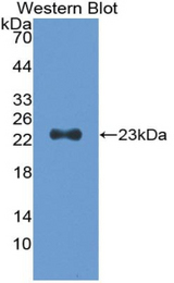 Western blot of recombinant TNNI1.