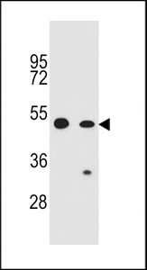 COP1 Antibody western blot of CEM,A549 cell line lysates (35 ug/lane). The COP1 antibody detected the COP1 protein (arrow).
