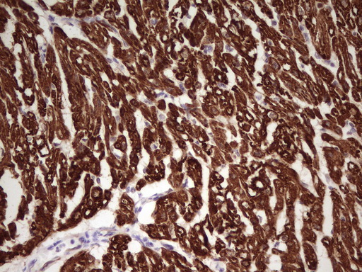 IHC of paraffin-embedded Human adult heart tissue using anti-TNNI1 mouse monoclonal antibody. (Heat-induced epitope retrieval by 1 mM EDTA in 10mM Tris, pH8.5, 120°C for 3min).