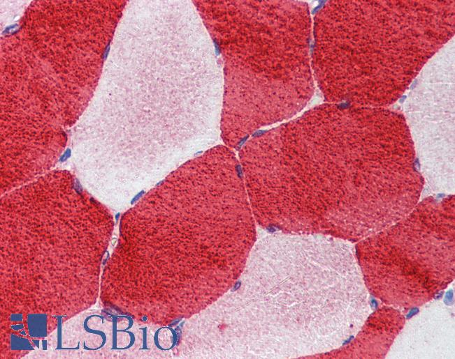 Anti-TNNI1 antibody IHC of human skeletal muscle. Immunohistochemistry of formalin-fixed, paraffin-embedded tissue after heat-induced antigen retrieval. Antibody LS-B3547 concentration 5 ug/ml.