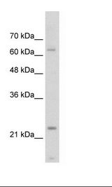 Jurkat Cell Lysate
