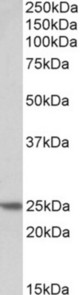 TNNI1 antibody (0.2 ug/ml) staining of Human Skeletal Muscle lysate (35 ug protein in RIPA buffer). Primary incubation was 1 hour. Detected by chemiluminescence.