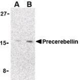 Western blot of precerebellin in 293 cell lysate with LS-C19528 at (A) 2 and (B) 4 ug/ml.