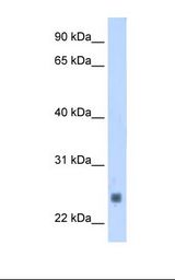 Fetal muscle cell lysate. Antibody concentration: 1.25 ug/ml. Gel concentration: 12%.
