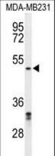 Western blot of CBX2 Antibody in MDA-MB231 cell line lysates (35 ug/lane). CBX2 (arrow) was detected using the purified antibody.