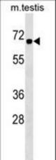 CBX2 Antibody western blot of mouse testis tissue lysates (35 ug/lane). The CBX2 antibody detected the CBX2 protein (arrow).