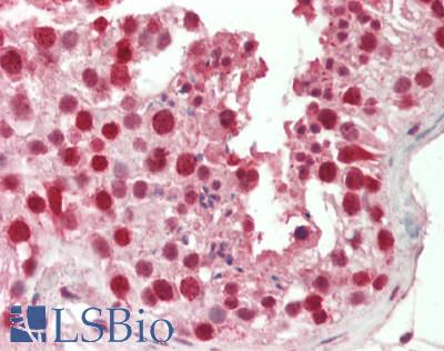 Human Testis: Formalin-Fixed, Paraffin-Embedded (FFPE)