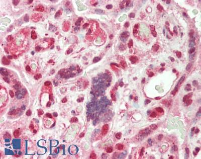 Human Placenta: Formalin-Fixed, Paraffin-Embedded (FFPE)