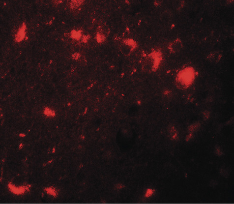 Immunofluorescence of CBX4 in human brain tissue with CBX4 antibody at 20 ug/ml.