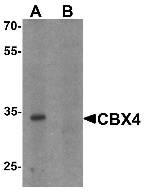 Western blot analysis of CBX4 in human brain tissue lysate with CBX4 antibody at 1 ug/ml in (A) the absence and (B) the presence of blocking peptide.