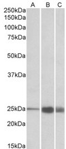 TNNI2 antibody (1 ug/ml) staining of Human (A), Mouse(B) and Rat (C) Skeletal Muscle lysate (35 ug protein in RIPA buffer). Primary incubation was 1 hour. Detected by chemiluminescence.