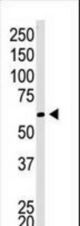 The anti-CBX4 C-term antibody is used in Western blot to detect CBX4 in Jurkat cell lysate.