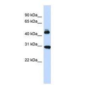 Western blot of Human Fetal Brain. CBX4 antibody dilution 1.0 ug/ml.