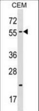 CBX4 Antibody western blot of CEM cell line lysates (35 ug/lane). The CBX4 antibody detected the CBX4 protein (arrow).
