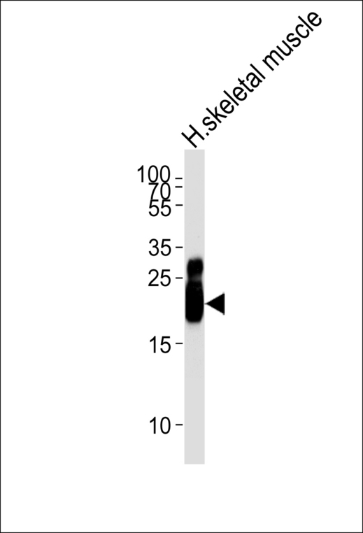 Western blot of lysate from human skeletal muscle tissue lysate, using TNNI2 Antibody. Antibody was diluted at 1:1000 at each lane. A goat anti-rabbit IgG H&L (HRP) at 1:5000 dilution was used as the secondary antibody. Lysate at 35ug per lane.