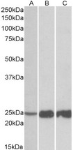 TNNI2 antibody (0.03 ug/ml) staining of Human (A), Mouse(B) and Rat (C) Skeletal Muscle lysate (35 ug protein in RIPA buffer). Primary incubation was 1 hour. Detected by chemiluminescence.