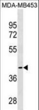 CCBL1 Antibody western blot of MDA-MB453 cell line lysates (35 ug/lane). The CCBL1 antibody detected the CCBL1 protein (arrow).