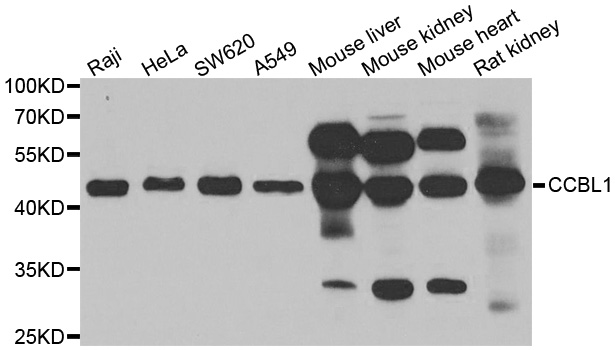 Western blot analysis of extracts of various cell lines, using CCBL1 antibody.