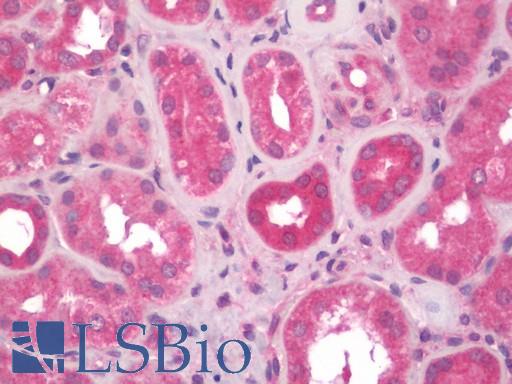 Human Kidney: Formalin-Fixed, Paraffin-Embedded (FFPE)