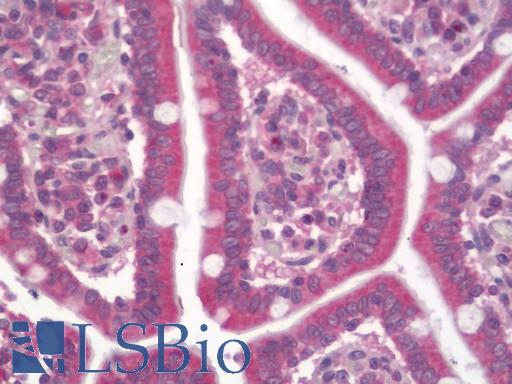 Human Small Intestine: Formalin-Fixed, Paraffin-Embedded (FFPE)