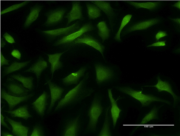 Immunofluorescence of monoclonal antibody to CCBL1 on HeLa cell . [antibody concentration 10 ug/ml]