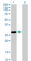 Western Blot analysis of CCBL1 expression in transfected 293T cell line by CCBL1 monoclonal antibody (M02), clone 1B12.Lane 1: CCBL1 transfected lysate(27.4 KDa).Lane 2: Non-transfected lysate.