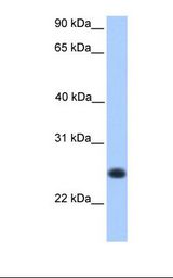 Fetal muscle lysate. Antibody concentration: 1.0 ug/ml. Gel concentration: 12%.
